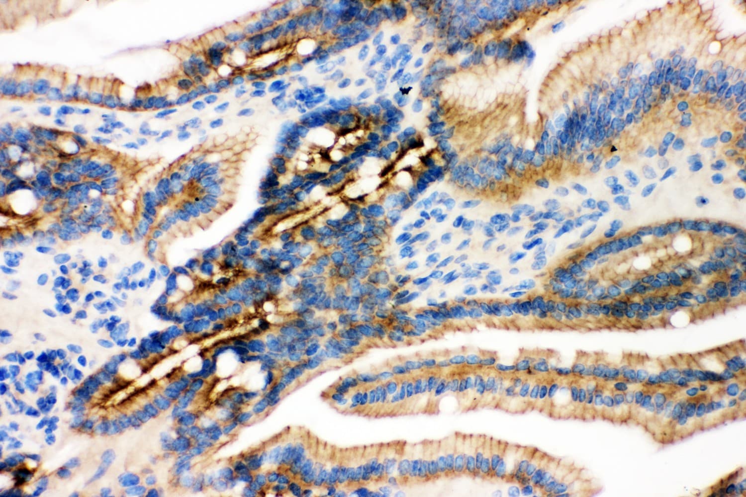 JUP/CTNNG/Junction Plakoglobin Antibody (aa556-745)