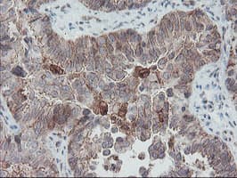 Monoclonal Mouse anti-Human SENP2 Antibody (clone OTI1D7, IHC, IF, WB)
