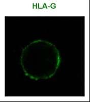 HLA-G Antibody (clone MEM-G/9)