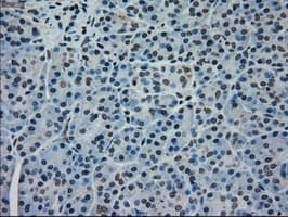 Monoclonal Mouse anti-Human MAPK1 / ERK2 Antibody (clone OTI4C2, IHC, IF, WB)