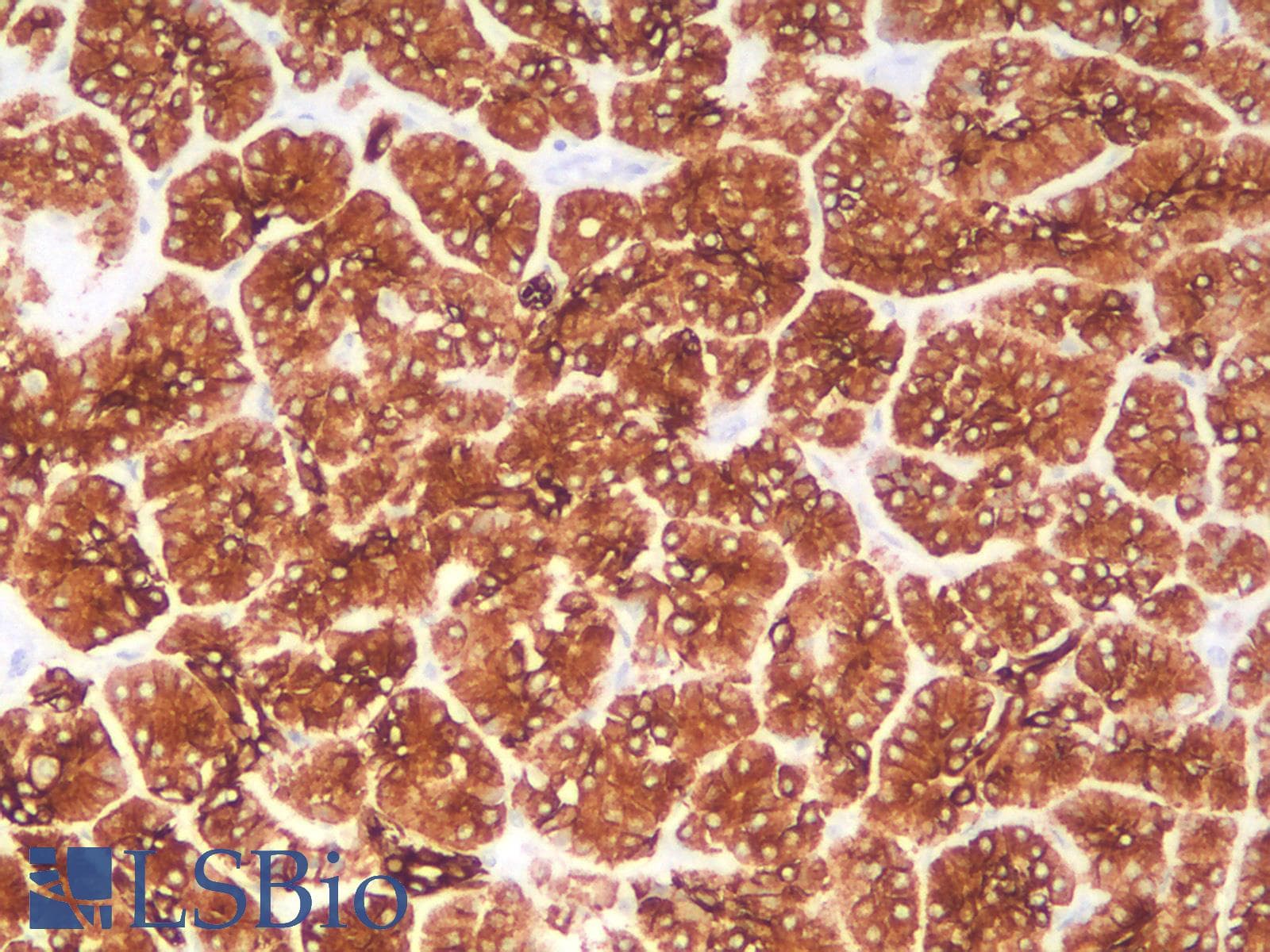 PathPlus™ Recombinant Monoclonal Rabbit anti-Human KRT18 / CK18 / Cytokeratin 18 Antibody (clone KRT18/2808R, IHC, IF, WB)