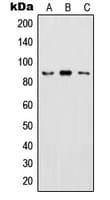 IKBKB / IKK2 / IKK Beta Antibody (phospho-Tyr199)