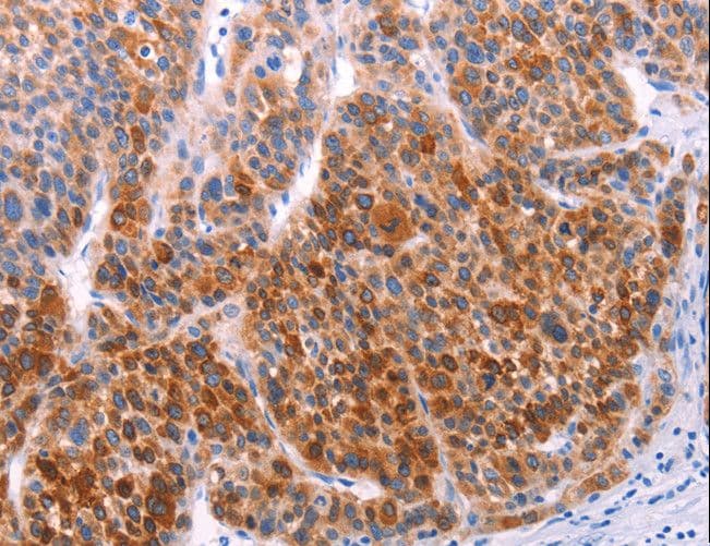 AADAC Antibody