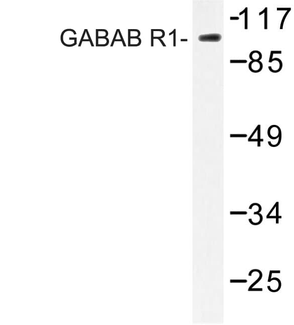 GABBR1 / GABA B Receptor 1 Antibody (Pro931)