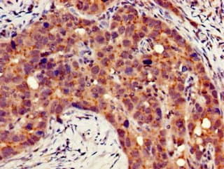 ITGB4 / Integrin Beta 4 Antibody