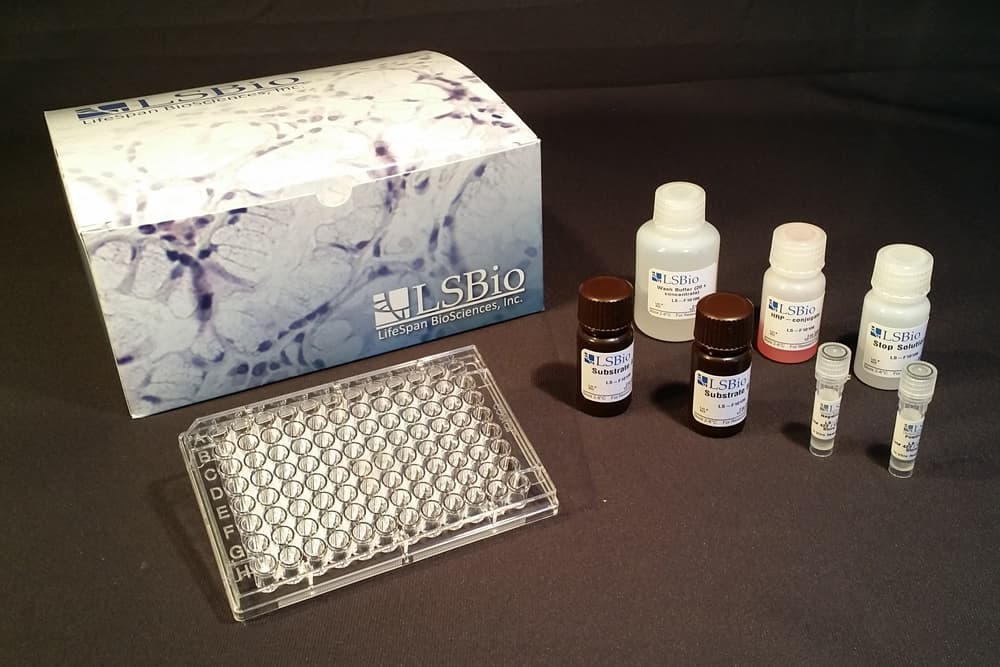 Human NODAL ELISA Kit (Sandwich ELISA)