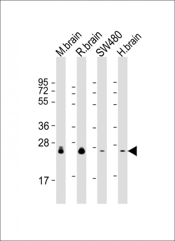 Monoclonal Mouse anti-Human RAB3B Antibody (clone 1543CT354.60.92, IHC, WB)