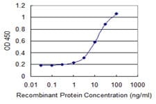 Monoclonal Mouse anti-Human ASXL1 Antibody (clone 6E2, WB)