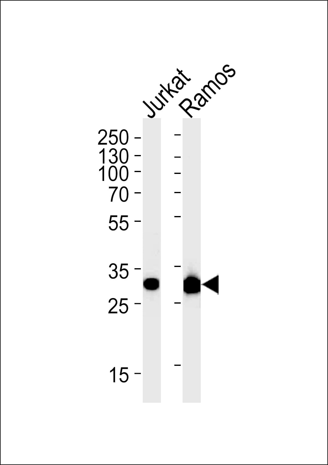 CASP3 / Caspase 3 Antibody (clone 1262CT521.280.101)