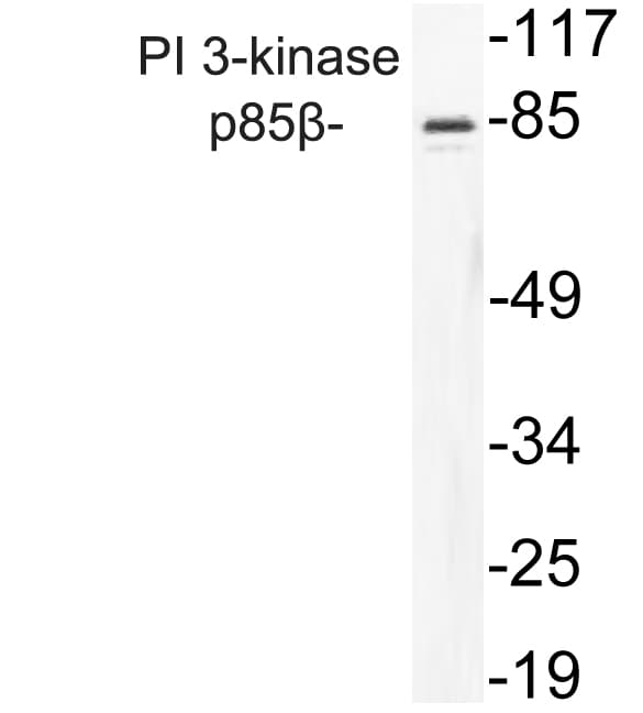 PIK3R2 / p85 Beta Antibody (aa409-458)