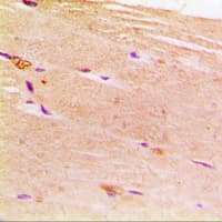 Polyclonal Rabbit anti-Human ACTN2 Antibody (N-Terminus, IHC, IF, WB)