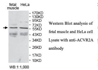 PathPlus™ Polyclonal Rabbit anti-Human ACVR2 / ACVR2A Antibody (aa45-305, IHC, WB)