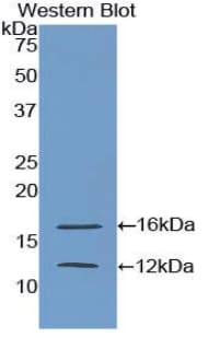 EMA / MUC1 Antibody (aa1034-1151, APC)