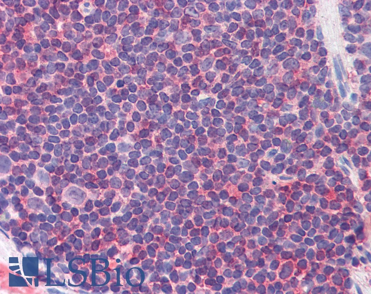 IHC-plus™ IL7R / CD127 Antibody (phospho-Tyr449)