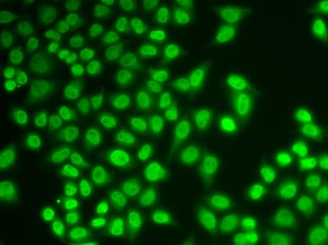 Polyclonal Rabbit anti-Human HNRNPK / hnRNP K Antibody (IHC, IF, WB)