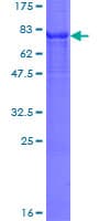Human CYP7B1 Protein (Recombinant GST)