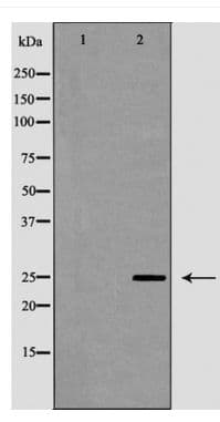 Polyclonal Rabbit anti-Human UCHL1 / PGP9.5 Antibody (IHC, WB)