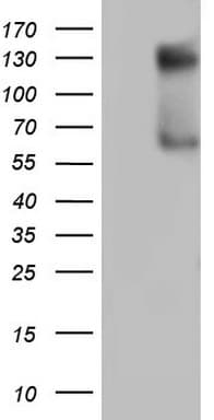 GLI / GLI1 Antibody (aa755-1106, clone OTI4C5)