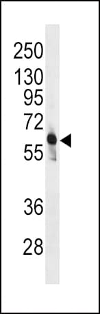 PFK2 / PFKFB3 Antibody (aa454-484)