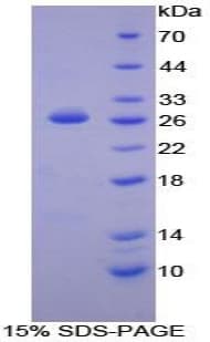 Mouse LAT Protein (Recombinant His-T7)