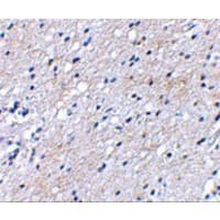 BAIAP3 Antibody