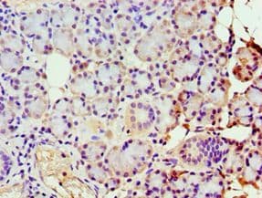 Polyclonal Rabbit anti-Human GBA3 / CBG Antibody (aa1-162, IHC, WB)