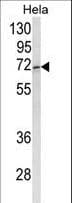 IHC-plus™ Polyclonal Rabbit anti-Human UBXD9 / ASPL Antibody (aa392-418, IHC, WB)