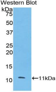 ESR2 / ER Beta Antibody (aa149-213)