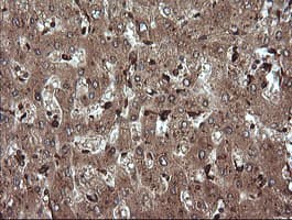 TRIM38 Antibody (clone OTI14B4)
