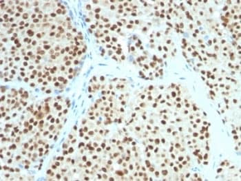 Monoclonal Mouse anti-Human SOX10 Antibody (clone SOX10/991, Ready-to-Use, IHC)