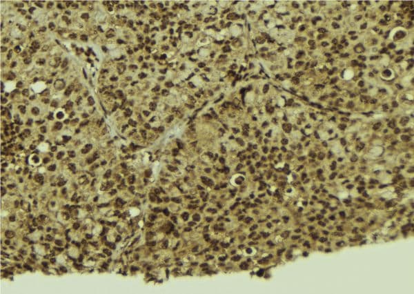 SP3 Antibody