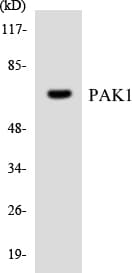 PAK1 Antibody (aa149-198)