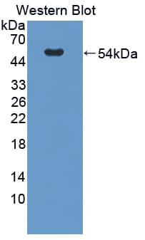 GLTP Antibody (aa2-209, PE)
