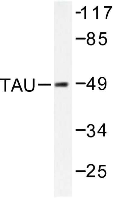 Polyclonal Rabbit anti-Human MAPT / Tau Antibody (Ala390, WB)