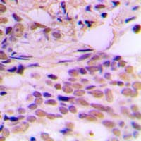 CDK7 Antibody (C-Terminus)