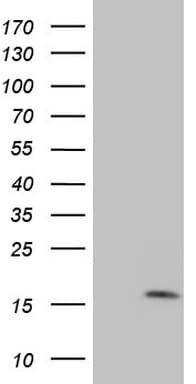 Monoclonal Mouse anti-Human MGP / Matrix Gla-Protein Antibody (clone 11G8, Carrier-free, IHC, WB)