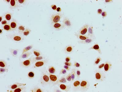 Polyclonal Rabbit anti-Human HIST1H1B Antibody (phospho-Ser17, WB)