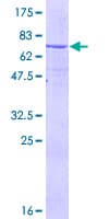 Human EPHX1 / Epoxide Hydrolase 1 Protein (Recombinant GST)