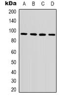 Monoclonal Mouse anti-Human CTNNB1 / Beta Catenin Antibody (IHC, WB)