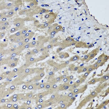 SCYL1 / NTKL Antibody