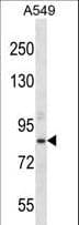 Junctin / ASPH Antibody (aa294-323)