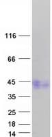 Human ACVR1C / ALK7 Protein (Recombinant Myc-DDK (Flag))