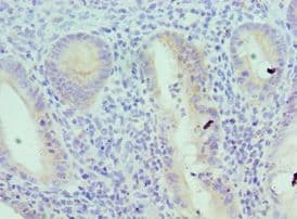 AcPL / IL18RAP Antibody (aa390-599)