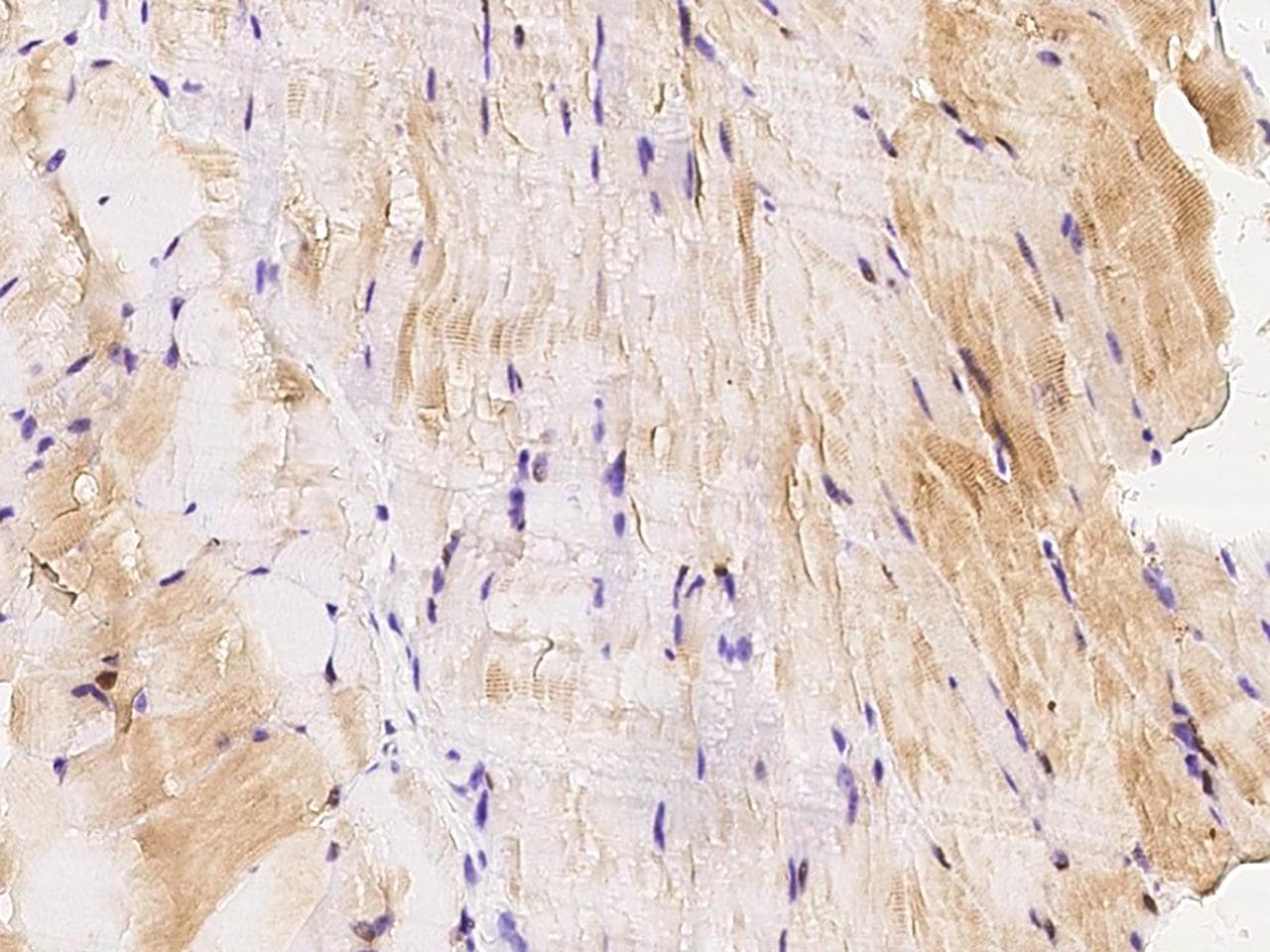 MAP2K3 / MEK3 / MKK3 Antibody (Preservative Free)