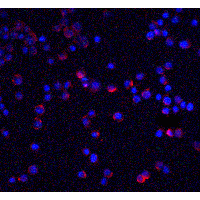 Polyclonal Rabbit anti-Human IL1RAP Antibody (IF, WB)
