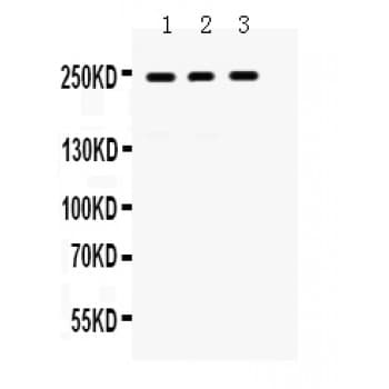 PTPRF Antibody (aa1167-1203)