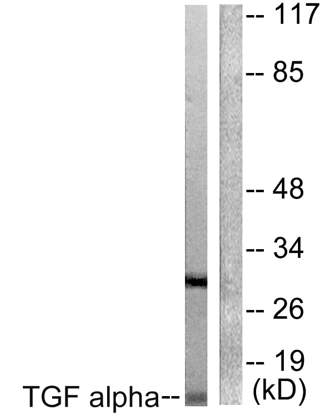 TGFA / TGF Alpha Antibody (aa111-160)