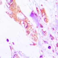 Polyclonal Rabbit anti-Human IL-1B / IL-1 Beta Antibody (Internal, IHC, WB)