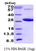 Human RAB5C Protein (Recombinant His)
