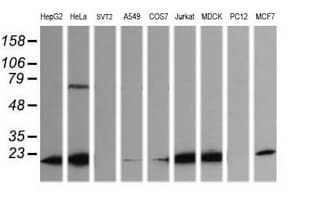 LZIC Antibody (clone OTI5F1)